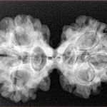 6 Mk Gaurishankar 32.6mm 5.57gm - Xray