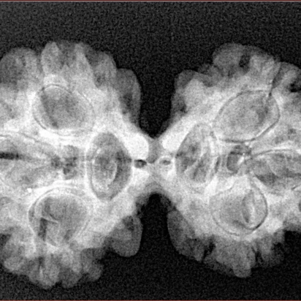 6 Mk Gaurishankar 32.6mm 5.57gm - Xray