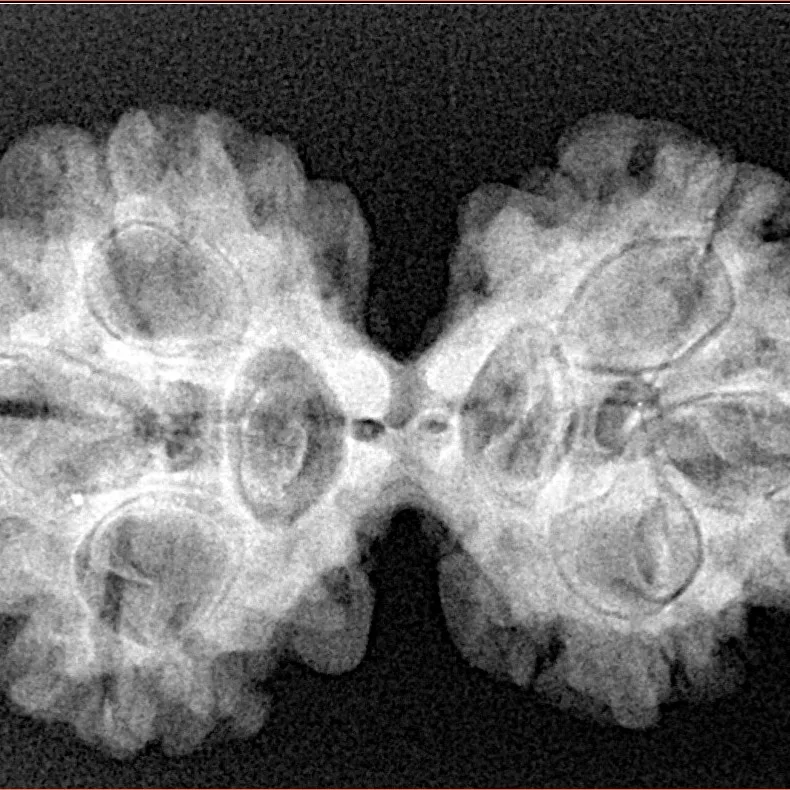 6 Mk Gaurishankar 32.6mm 5.57gm - Xray