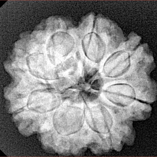 8 Mukhi Rudraksha 24.6mm 5.14gm - Xray