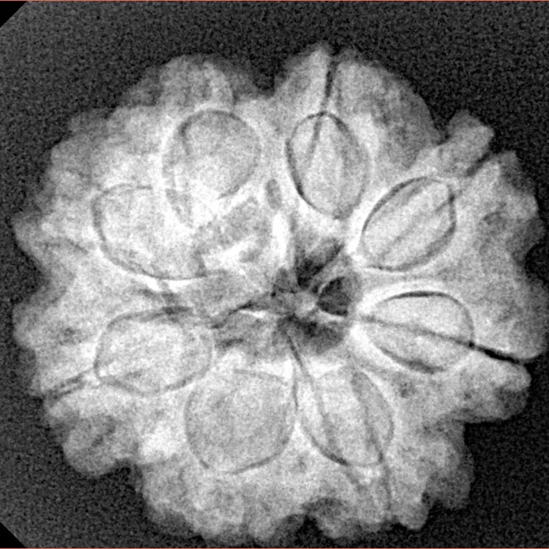 8 Mukhi Rudraksha 24.6mm 5.14gm - Xray