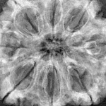 8 Mukhi Rudraksha 33.2mm 8.21gm - Xray