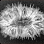 18 Mukhi Rudraksha 30mm 4.22gm - Xray