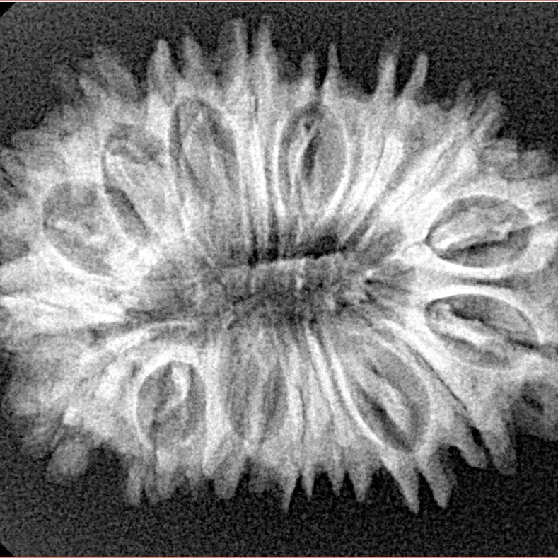 18 Mukhi Rudraksha 30mm 4.22gm - Xray