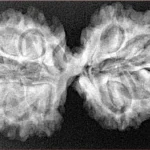 11 MK Gaurishankar 36.3mm 5.66gm - Xray