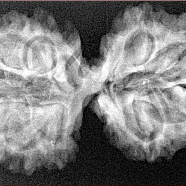 11 MK Gaurishankar 36.3mm 5.66gm - Xray