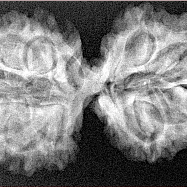 11 MK Gaurishankar 36.3mm 5.66gm - Xray