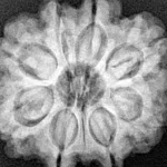 8 Mukhi Rudraksha 27.2mm 5.71gm - Xray