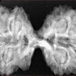9 MK Gaurishankar 40.8mm 8.83gm - Xray