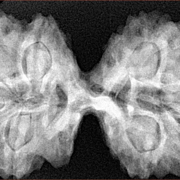 9 MK Gaurishankar 40.8mm 8.83gm - Xray