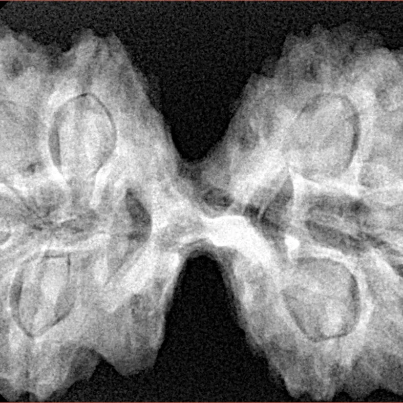 9 MK Gaurishankar 40.8mm 8.83gm - Xray