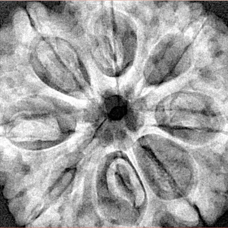 8 Mukhi Rudraksha 32.4mm 8.68gm - Xray