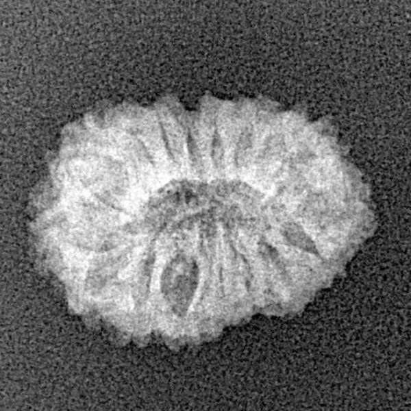 17 Mukhi Rudraksha 18.2mm 1.23gm - Xray