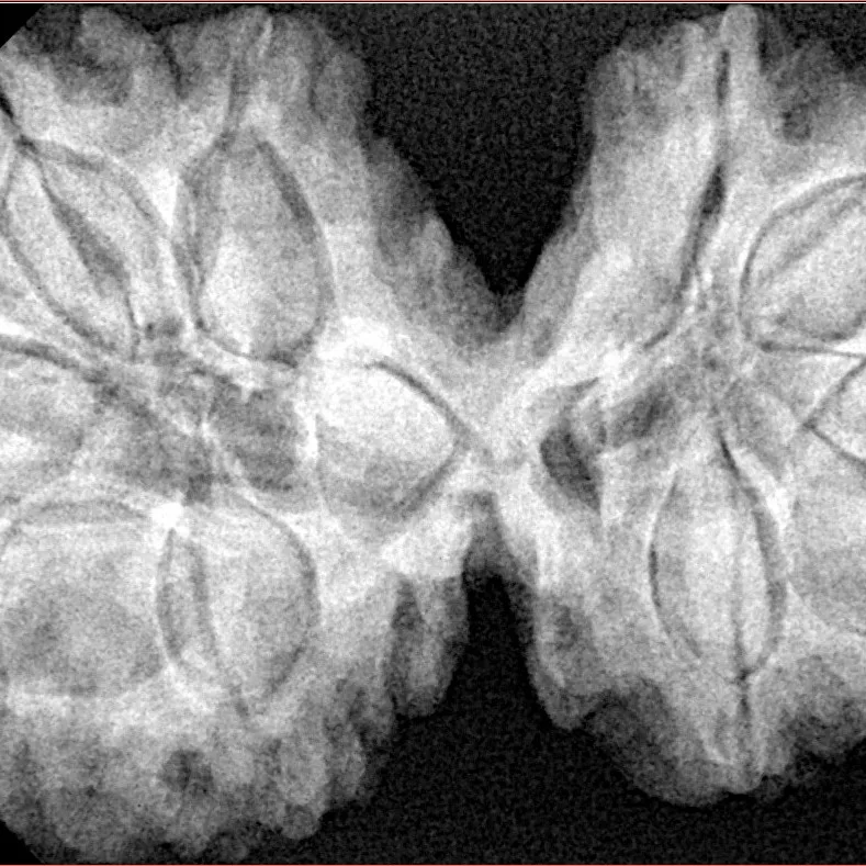 10 Mk Gaurishankar 39.4mm 9.2gm - Xray