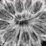 12 Mukhi Rudraksha 38.6mm 8.75gm - Xray