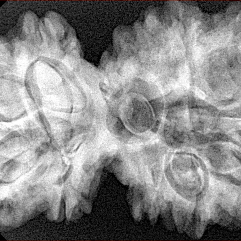 10 Mk Gaurishankar 39.8mm 9.31gm - Xray