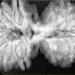 10 Mk Gaurishankar 40.1mm 9.72gm - Xray