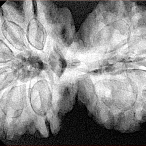 10 Mk Gaurishankar 40.1mm 9.72gm - Xray