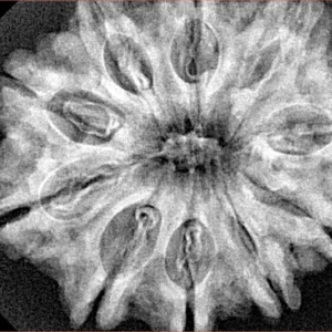10 Mukhi Rudraksha 31.1mm 6.2gm - Xray