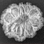 9 Mukhi Rudraksha 22.6mm 2.78gm - Xray