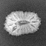 17 Mukhi Rudraksha 17.1mm 0.93gm - Xray