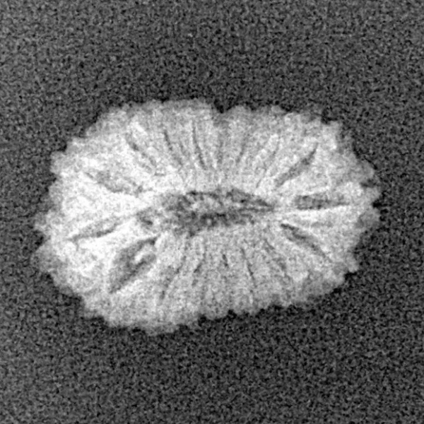 17 Mukhi Rudraksha 17.1mm 0.93gm - Xray