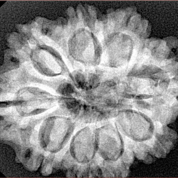 9 Mukhi Rudraksha 29.3mm 5.86gm - Xray
