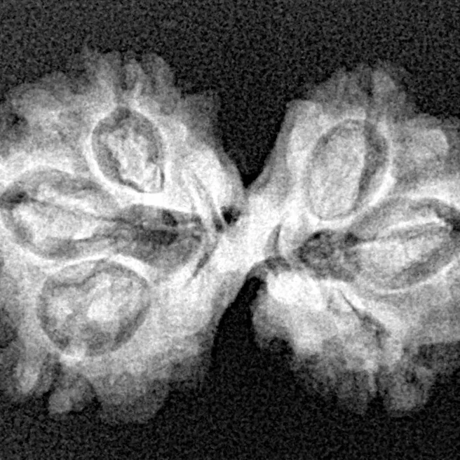 7 MK Gaurishankar 26.6mm 2.92gm - Xray