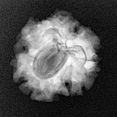 1 Mukhi Rudraksha 20.7mm 2.51gm - Xray