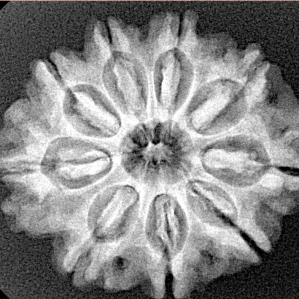 9 Mukhi Rudraksha 26.8mm 5gm - Xray