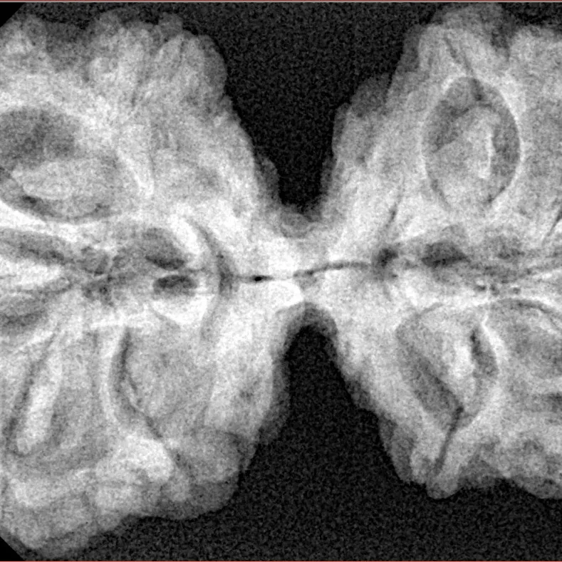 10 Mk Gaurishankar 40.5mm 7.85gm - Xray