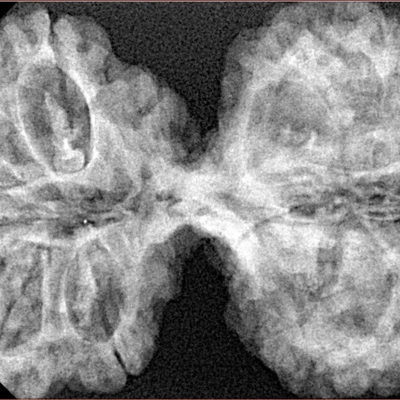 12 MK Gaurishankar 41.1mm 7.82gm - Xray