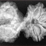 10 Mk Gaurishankar 37mm 7.7gm - Origin: Nepal - Xray