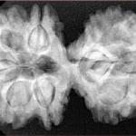 10 Mk Gaurishankar 40mm 8.26gm - Xray