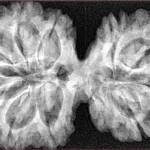 10 Mk Gaurishankar 38.9mm 8.21gm - Xray