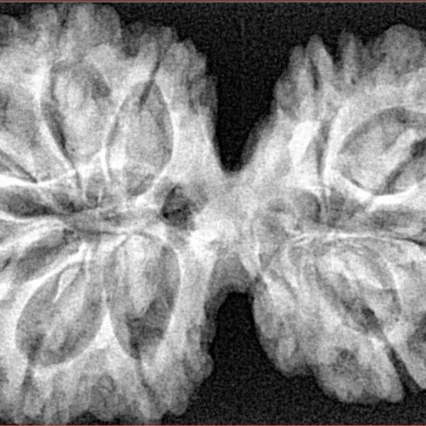 10 Mk Gaurishankar 38.9mm 8.21gm - Xray