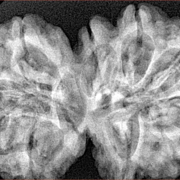11 MK Gaurishankar 38.7mm 8.52gm - Xray