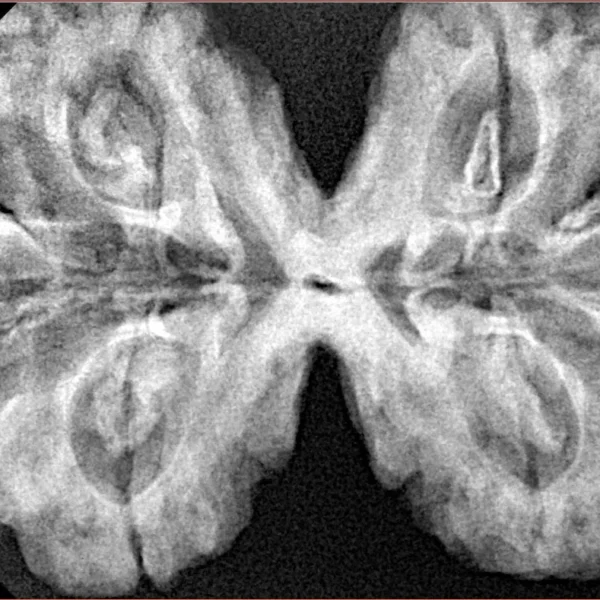 8 MK Gaurishankar 41.1mm 10.62gm - Xray