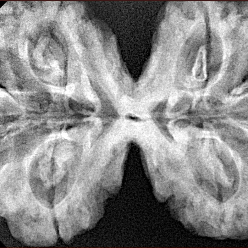 8 MK Gaurishankar 41.1mm 10.62gm - Xray