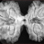 10 Mk Gaurishankar 38.3mm 9.09gm - Xray