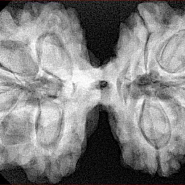 10 Mk Gaurishankar 38.3mm 9.09gm - Xray