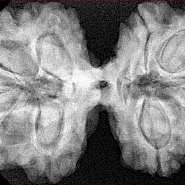 10 Mk Gaurishankar 38.3mm 9.09gm - Xray