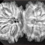 13 MK Gaurishankar 37.1mm 6.59gm - Xray