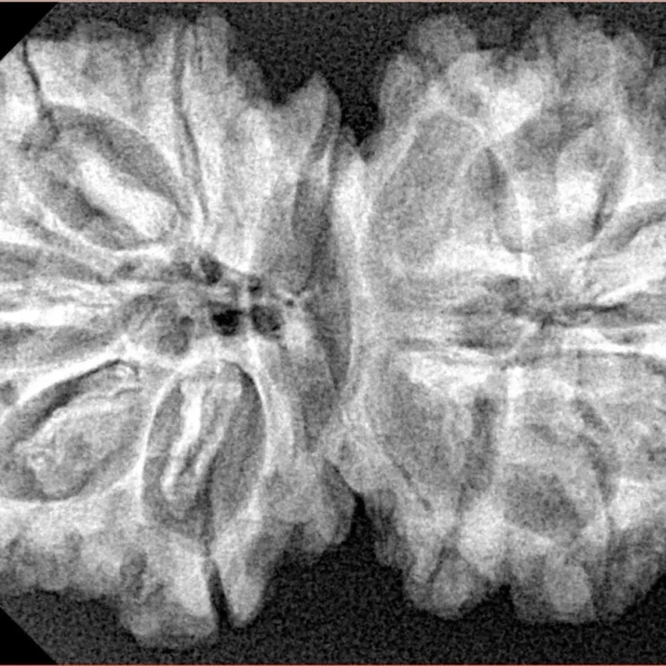 13 MK Gaurishankar 37.1mm 6.59gm - Xray