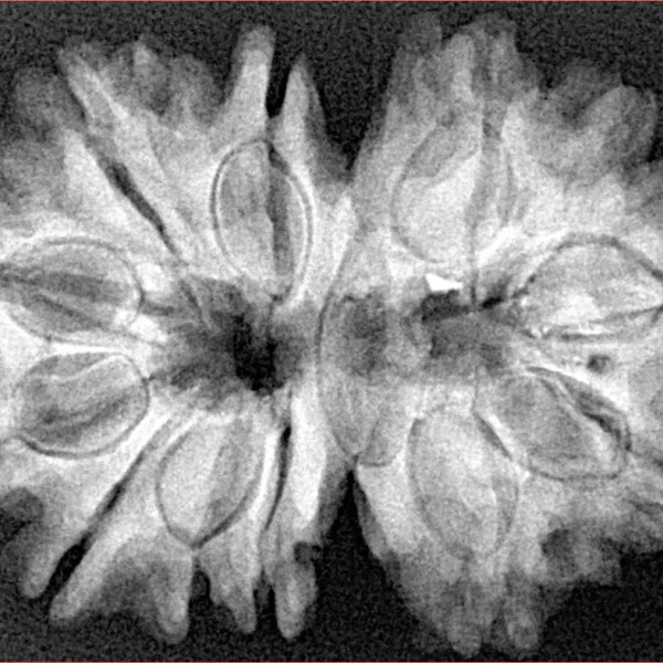 13 MK Gaurishankar 32.1mm 6gm - Xray