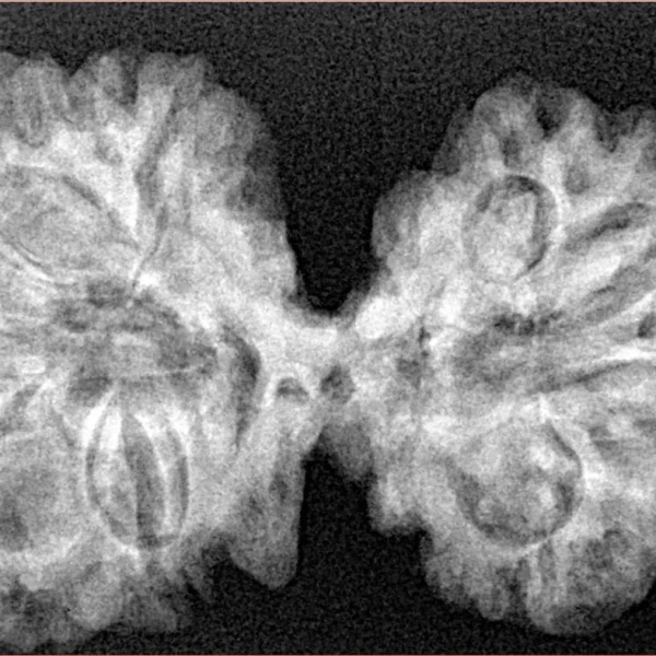 9 MK Gaurishankar 38.6mm 6.7gm - Xray