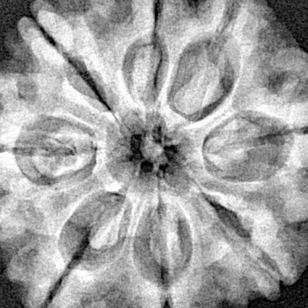 8 Mukhi Rudraksha 28.9mm 6.76gm - Xray