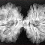 10 Mk Gaurishankar 37.1mm 7.33gm - Xray