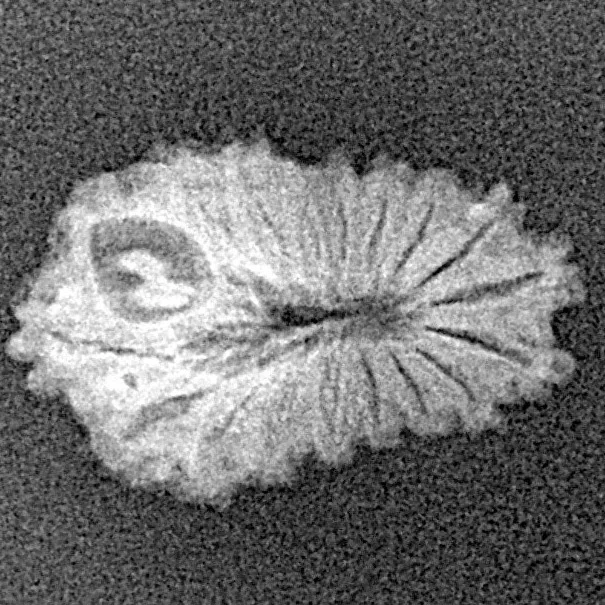 17 Mukhi Rudraksha 18.9mm 0.93gm - Xray