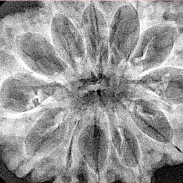 12 Mukhi Rudraksha 34.3mm 6.36gm - Xray